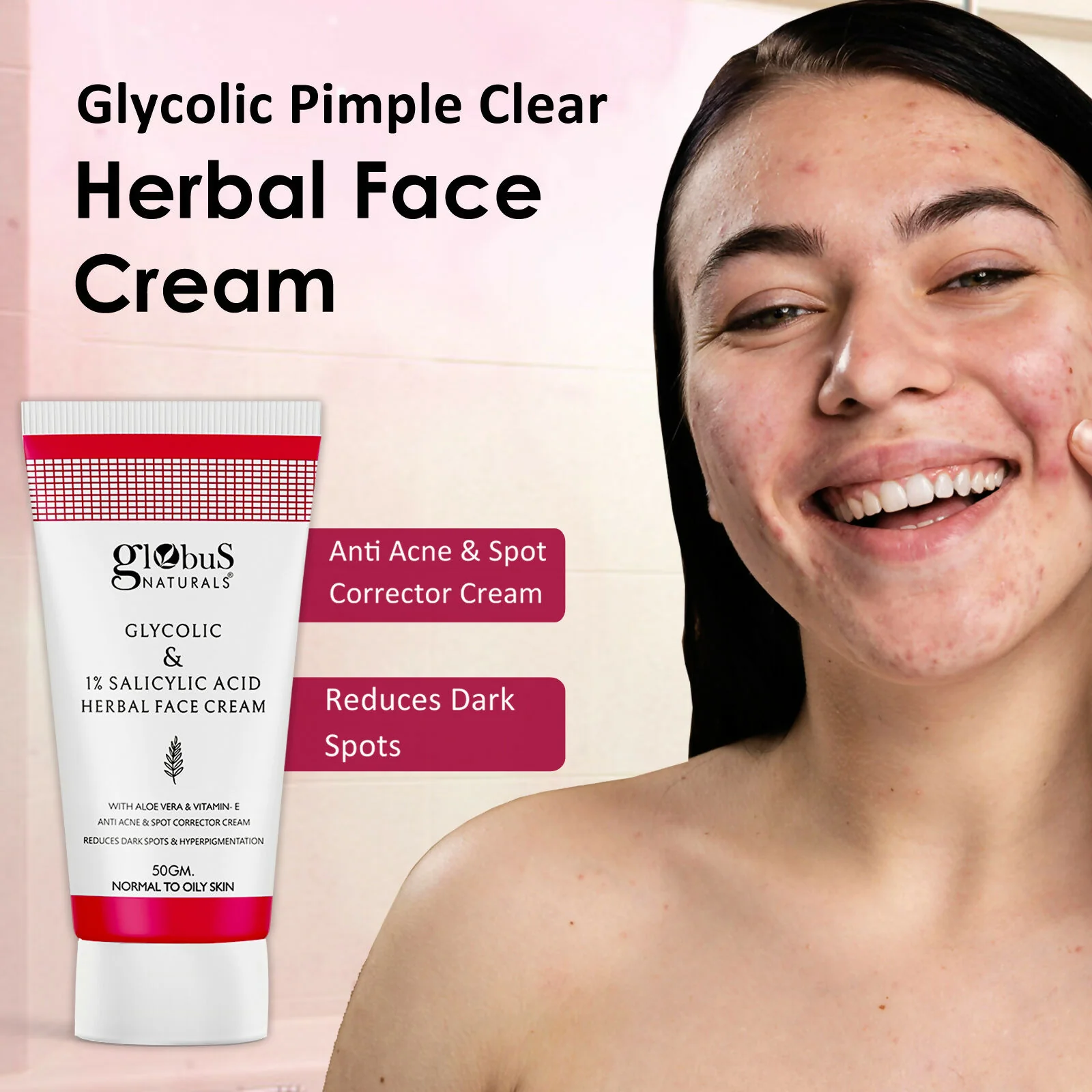 Globus Naturals Glycolic & 1% Salicylic Acid Herbal Anti Acne Face Cream - Image 5