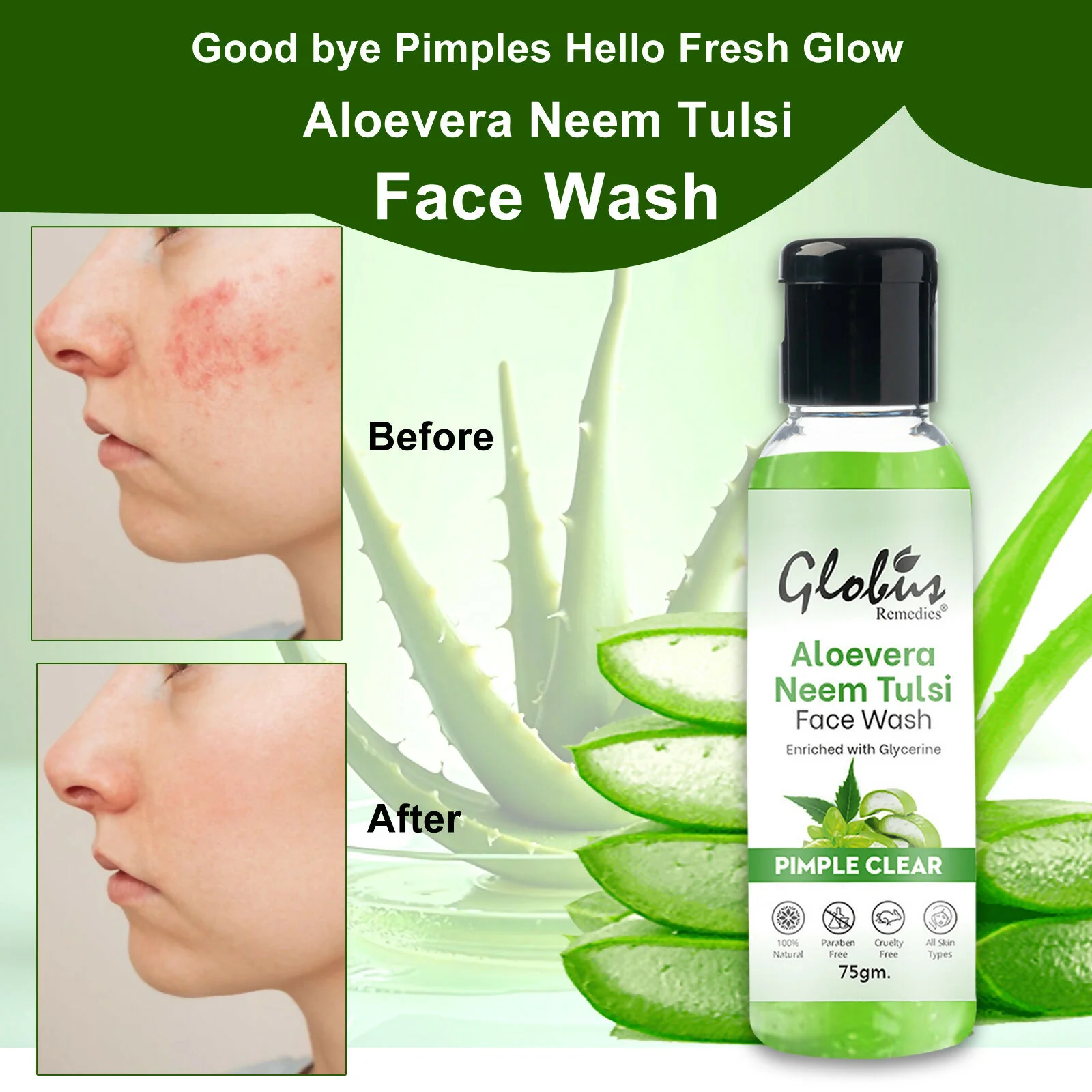 Globus Remedies Aloe vera Neem Tulsi Enriched With Glycerin & Oil Control Formula - Image 3