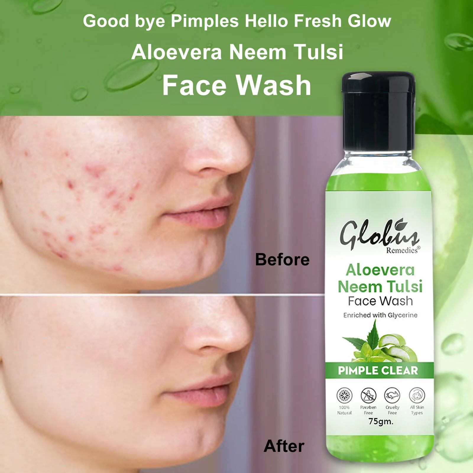 Globus Remedies Aloe vera Neem Tulsi Enriched With Glycerin & Oil Control Formula - Image 5