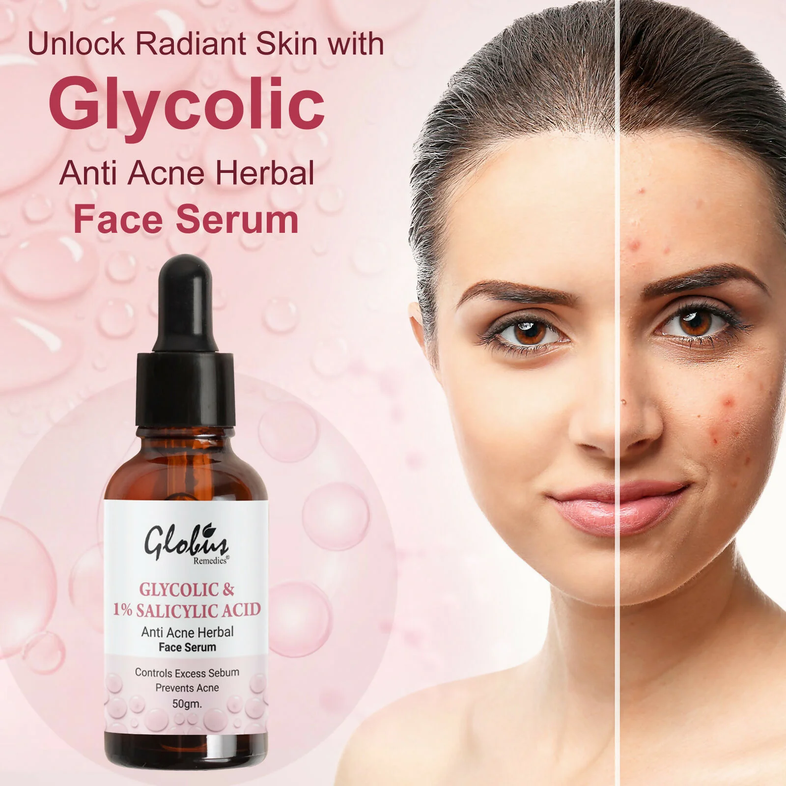 Globus Remedies Glycolic & 1% Salicylic Acid Anti Acne Face Serum - Image 3