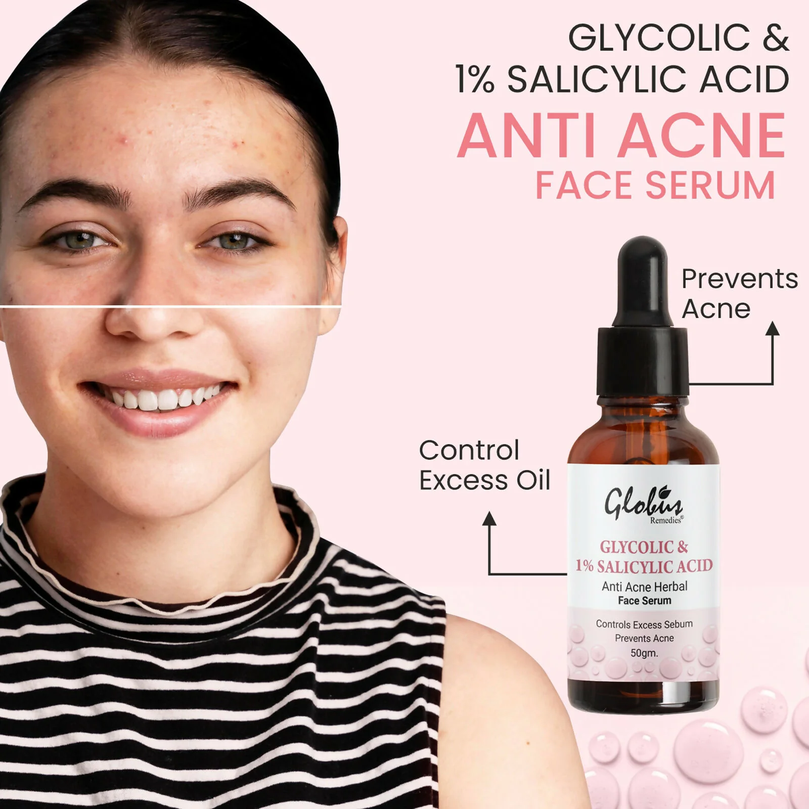 Globus Remedies Glycolic & 1% Salicylic Acid Anti Acne Face Serum - Image 4