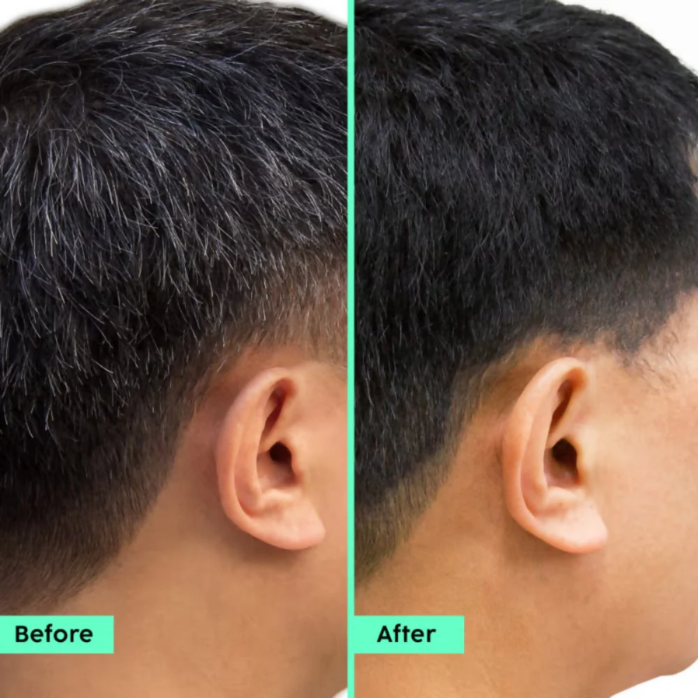 PLIX The Plant Fix Rosemary Advanced Hair Kit - Image 10